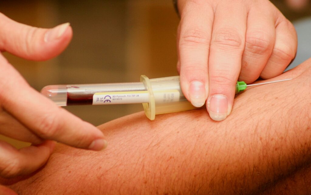 an apob blood test for cholesterol may be more accurate than LDL