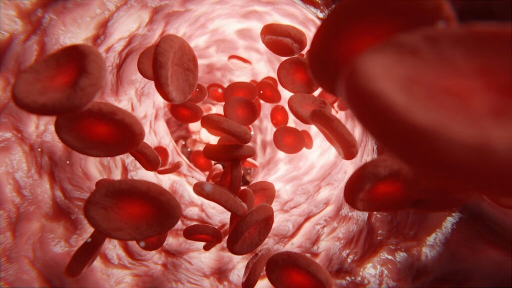 cholesterol can build up in arteries and an abop test looks for the particles that can lead to that