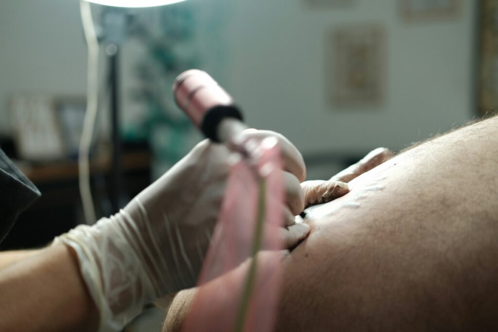Doctor performing a skin tags removal procedure in a clinical setting